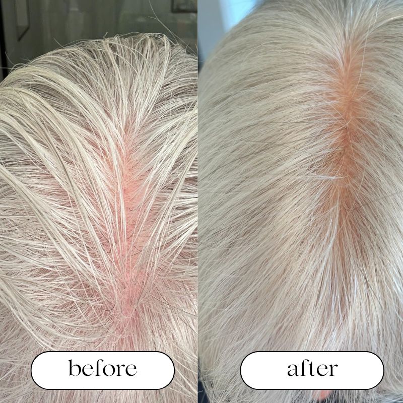 Red Light Therapy Cap with before and after of older woman.jpg__PID:3e51f4f2-540a-4e39-ae0c-54ede14b0bc7