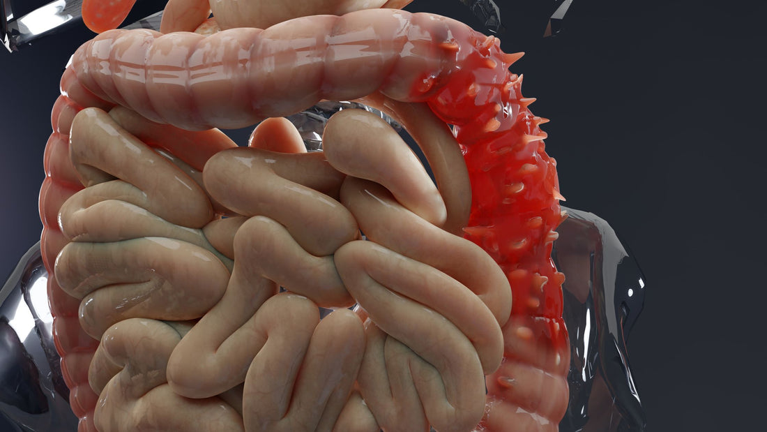 Anatomy of the human digestive system, concept of the intestine, diverticulitis, 3d render