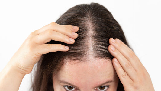 Hair Loss Image