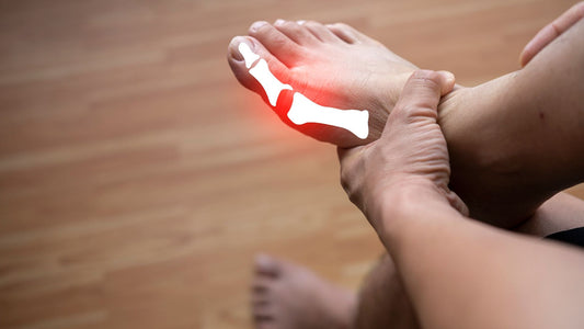 Red Light Therapy for Gout