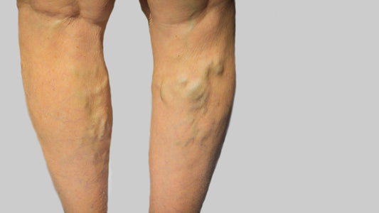 close up of the back of a womans legs