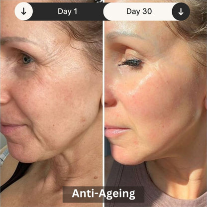 LED Light Therapy Mask