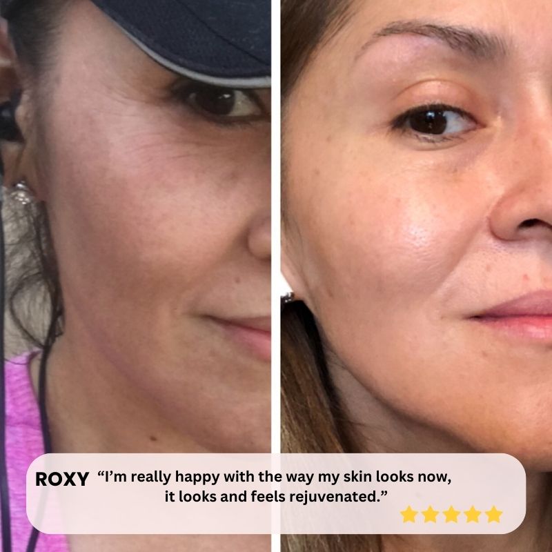 LED Light Therapy Mask