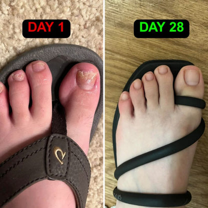 Before and after of nails