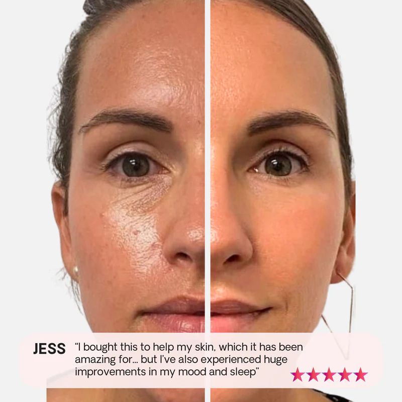 Before_and_after_of_using_panel_-_Jess