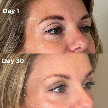 Day_1_vs_Day_30_Under_Eyes_1