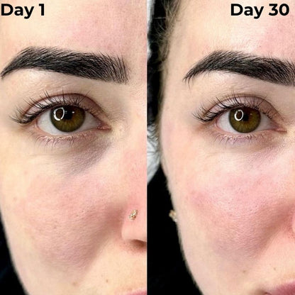 Day_1_vs_Day_30_Under_Eyes_3