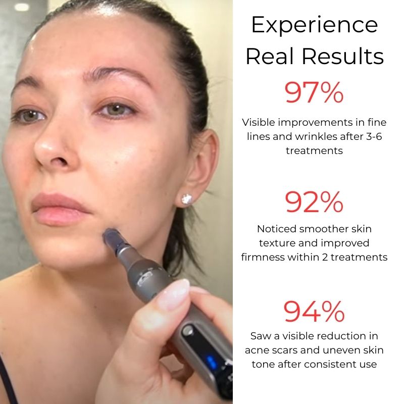 Dr_Pen_M8s_Pen_Results