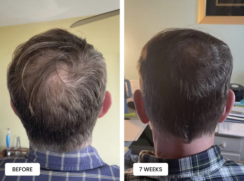 Hair_Growth_Before_And_After_3