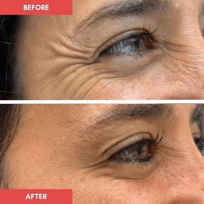 Holly_eye_mask_before_and_after_2