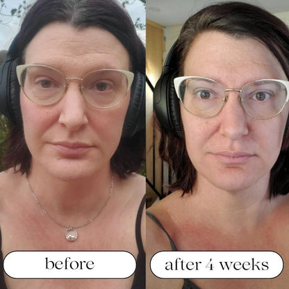 Before and After using Light Therapy