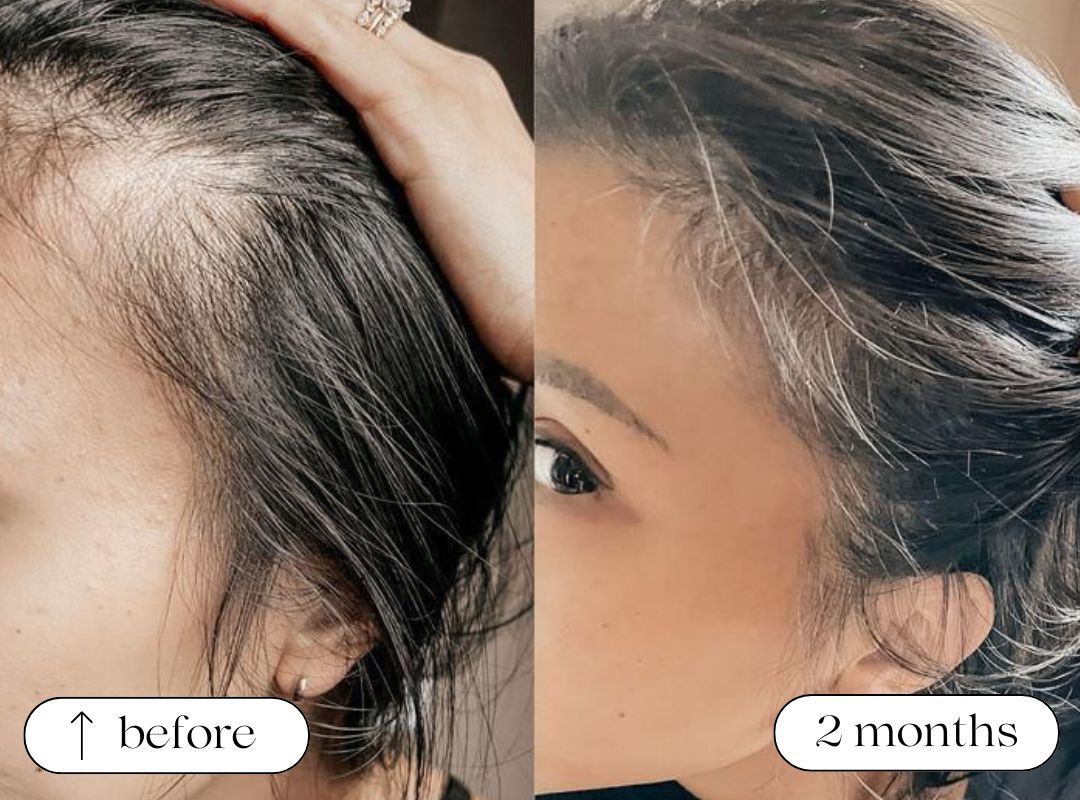 Laser Helmet Before and After 5