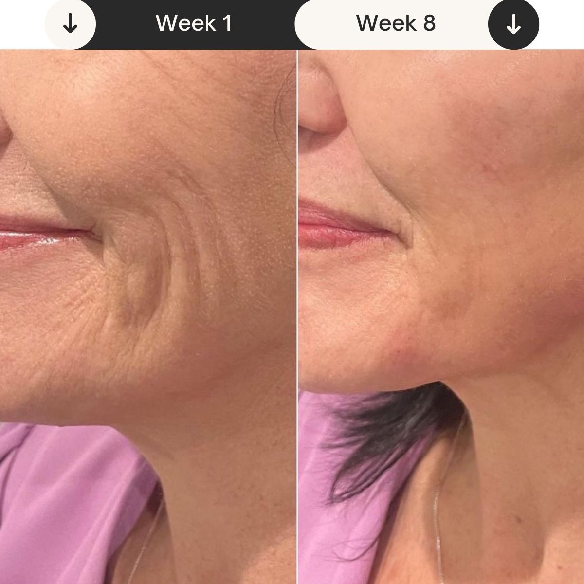 Laser Mask Review 74