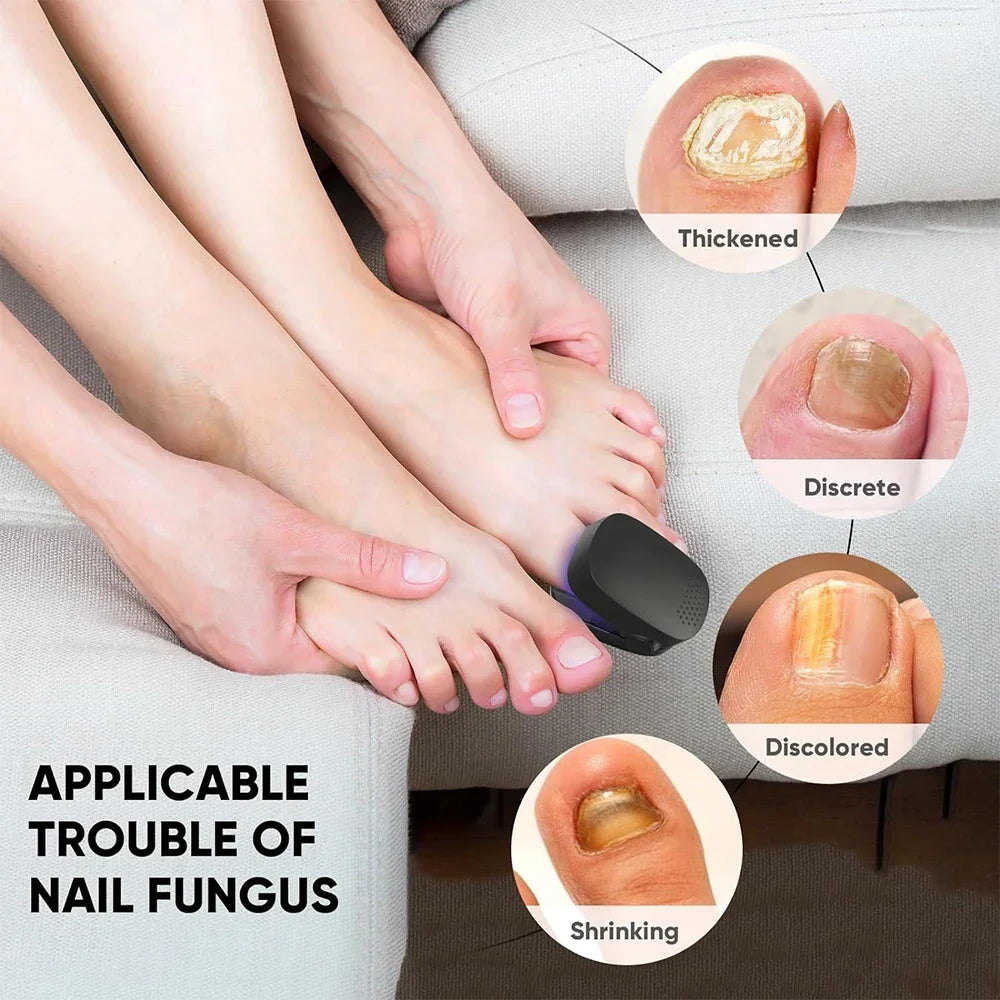 Laser Treatment Device for Nail Fungus different applications