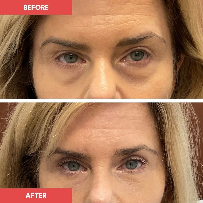 Regina_eye_mask_before_and_after_3