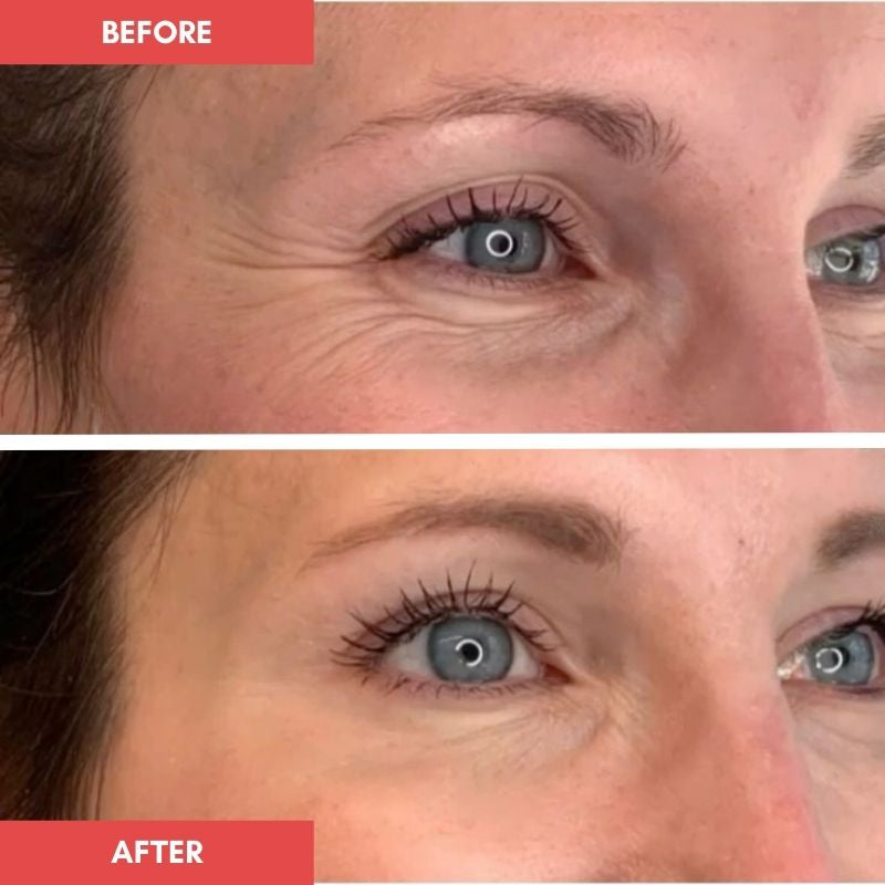 Tiarne_eye_mask_before_and_after_1