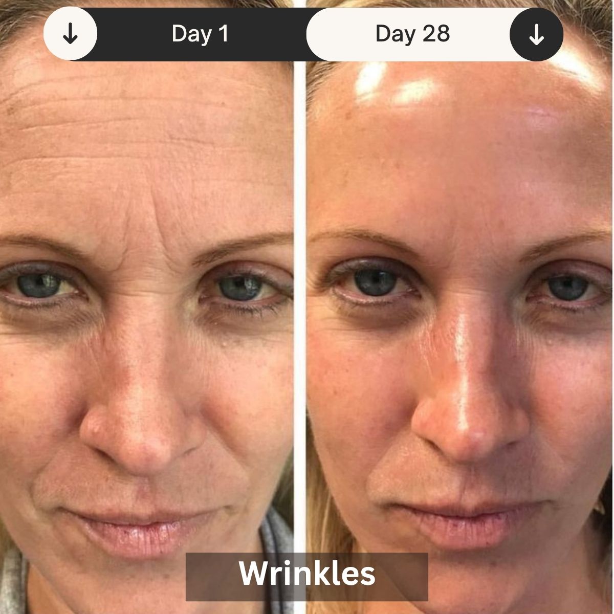 LED Light Therapy Mask