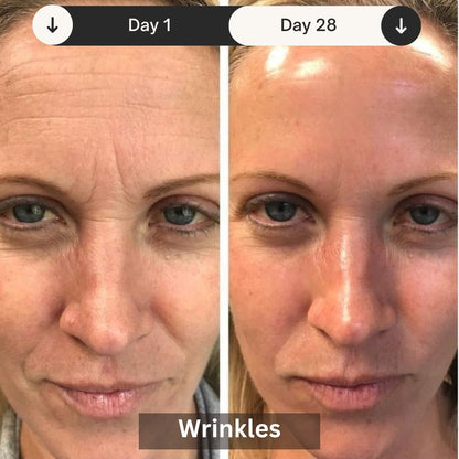 LED Light Therapy Mask