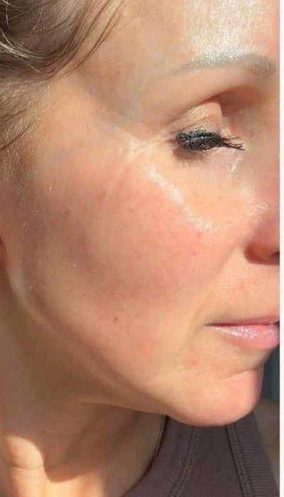 Anti-Ageing - After