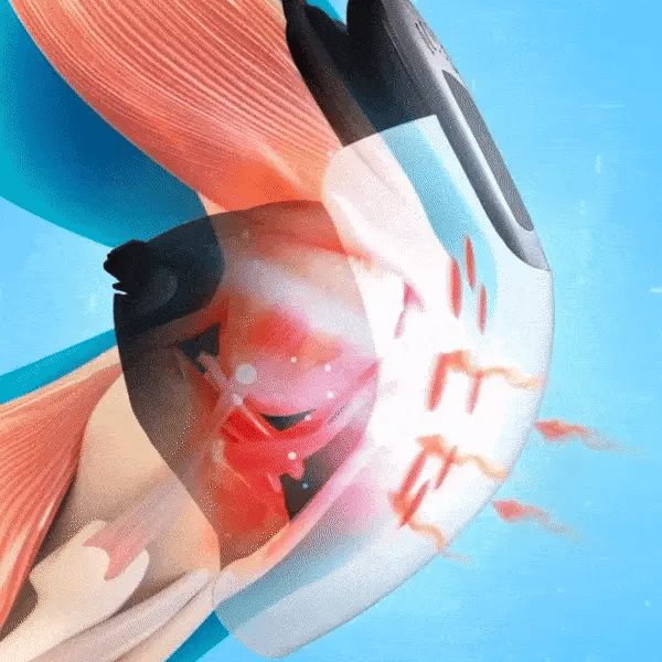 knee massager gif.gif__PID:d3cf7867-2e47-43e0-9210-b52a6ff84a12