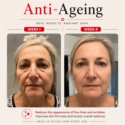 laser_mask_before_and_after_anti-ageing