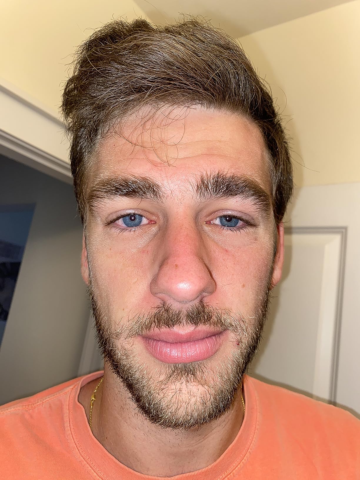 man staring into camera