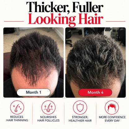 redlighttherapycapbeforeandafter2