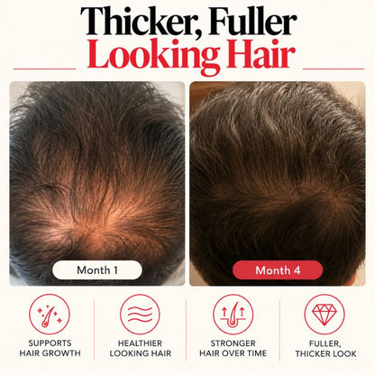 redlighttherapycapbeforeandafter3