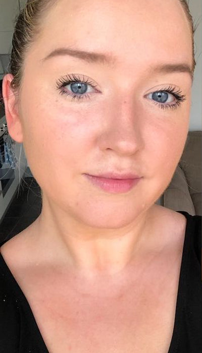 Redness - After