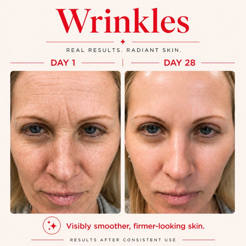 results_of_led_light_therapy_2