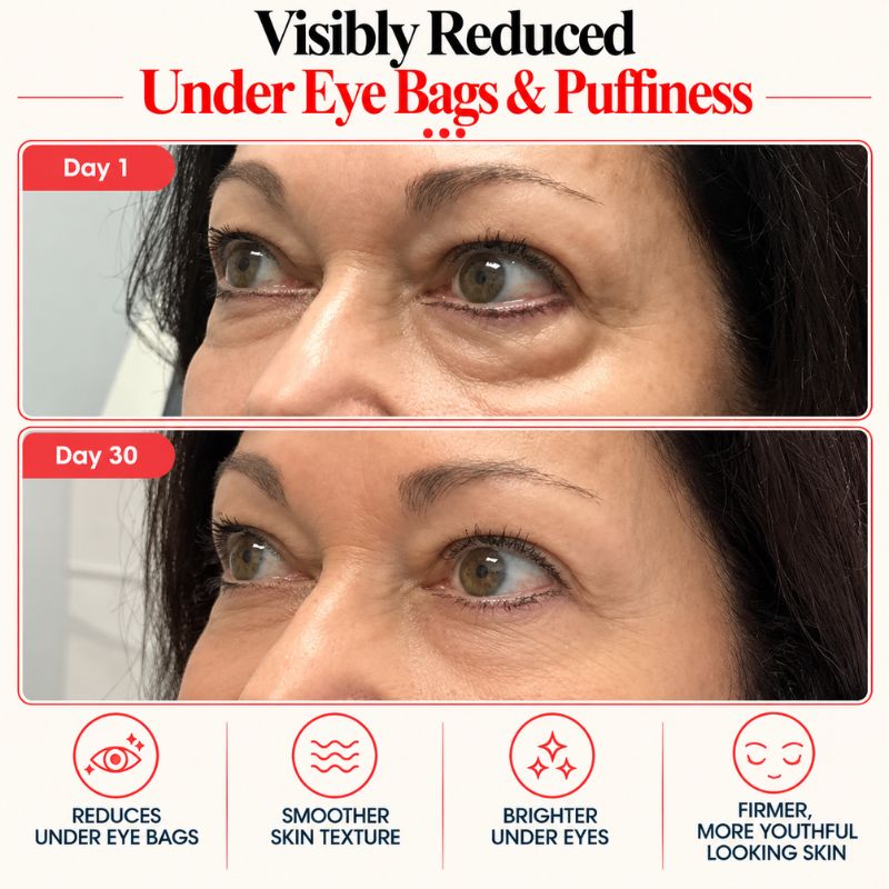undereyeredlighttherapymaskbeforeandafter1