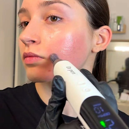 womanusingm9microneedlingpenonface2